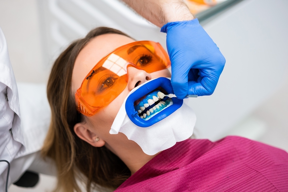 вредно ли зум отбеливание зубов
